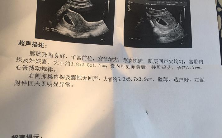 去香港验血查性别需要符合什么条件,如何预约，很简单的