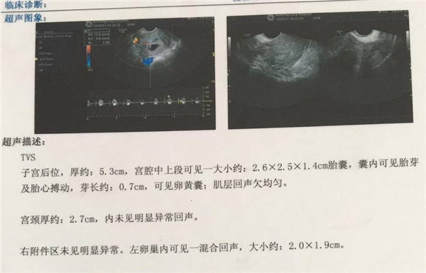 香港查男孩女孩？宝妈亲身经历告诉你真相